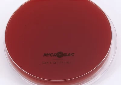 AGAR MUELLER MODIFICADO